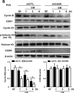 Fig.5.B showing Western Blotting in a Homo sapiens (Human) sample from the publication: CASK promotes non-small cell lung cancer growth through coordinated regulation of EGFR expression, trafficking, and p21 expression.