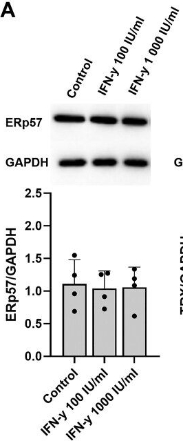 Fig.2.A showing Western Blotting in a Homo sapiens (Human) sample from the publication: Targeting transglutaminase 2: pathways to celiac disease therapies.