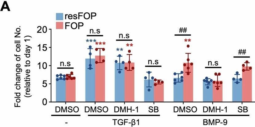 Fig.6.A from the publication: BMP-9 mediates fibroproliferation in fibrodysplasia ossificans progressiva through TGF-β signaling.