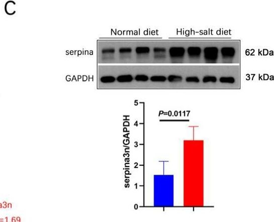 Fig.5.C showing Western Blotting in a Mus musculus (House mouse) sample from the publication: High-Salt Diet Accelerates Neuron Loss and Anxiety in APP/PS1 Mice Through Serpina3n.