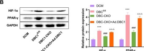 Fig.6.B showing Western Blotting in a Mus musculus (House mouse) sample from the publication: The DBC1-HIF-1α-PPAR-γ axis regulates Treg cell differentiation to promote myocardial fibrosis in experimental diabetic cardiomyopathy through the paracrine secretion of Areg.