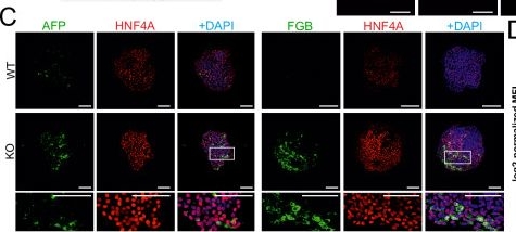 Fig.5.C showing Immunocytochemistry-immunofluorescence in a Homo sapiens (Human) sample from the publication: Oxidative stress and GPX2 control pancreatic vs. non-pancreatic cell fate in human endoderm.