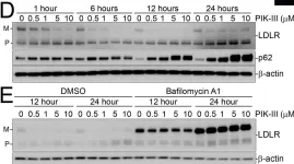 Fig.4.D showing Western Blotting from the publication: An iron-dependent metabolic vulnerability underlies VPS34-dependence in RKO cancer cells.