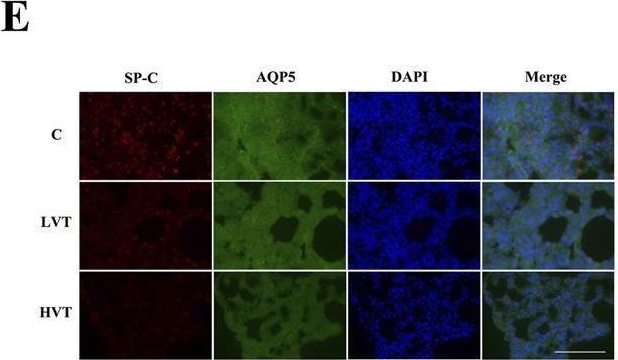 Fig.1.E showing Immunocytochemistry-immunofluorescence from the publication: YAP activity protects against ventilator-induced lung injury.