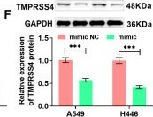 Fig.4.F showing Western Blotting from the publication: miR-149-3p targeting TMPRSS4 regulates the sensitivity to cisplatin to inhibit the progression of lung cancer.