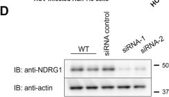 Fig.5.D showing Western Blotting in a Homo sapiens (Human) sample from the publication: Protein tyrosine kinase Src suppresses hepatitis C virus particle release through regulation of Ndrg1.
