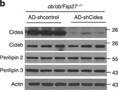 Fig.7.B showing Western Blotting in a Mus musculus (House mouse) sample from the publication: Insulin resistance and white adipose tissue inflammation are uncoupled in energetically challenged Fsp27-deficient mice.