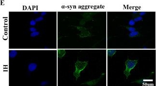 Fig.3.E showing Immunocytochemistry-immunofluorescence in a Homo sapiens (Human) sample from the publication: Molecular mechanisms of α-syn abnormal phase separation in cognitive impairment induced by chronic intermittent hypoxia and the neuroprotective effects of Danshensu methyl ester.
