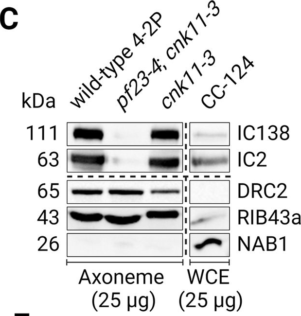 Fig.2.C showing Western Blotting from the publication: Gene dosage of independent dynein arm motor preassembly factors influences cilia assembly in Chlamydomonas reinhardtii.