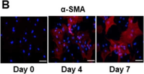 Fig.1.B showing Immunocytochemistry-immunofluorescence in a Homo sapiens (Human) sample from the publication: Differentiation of Adipose-Derived Stem Cells into Vascular Smooth Muscle Cells for Tissue Engineering Applications.