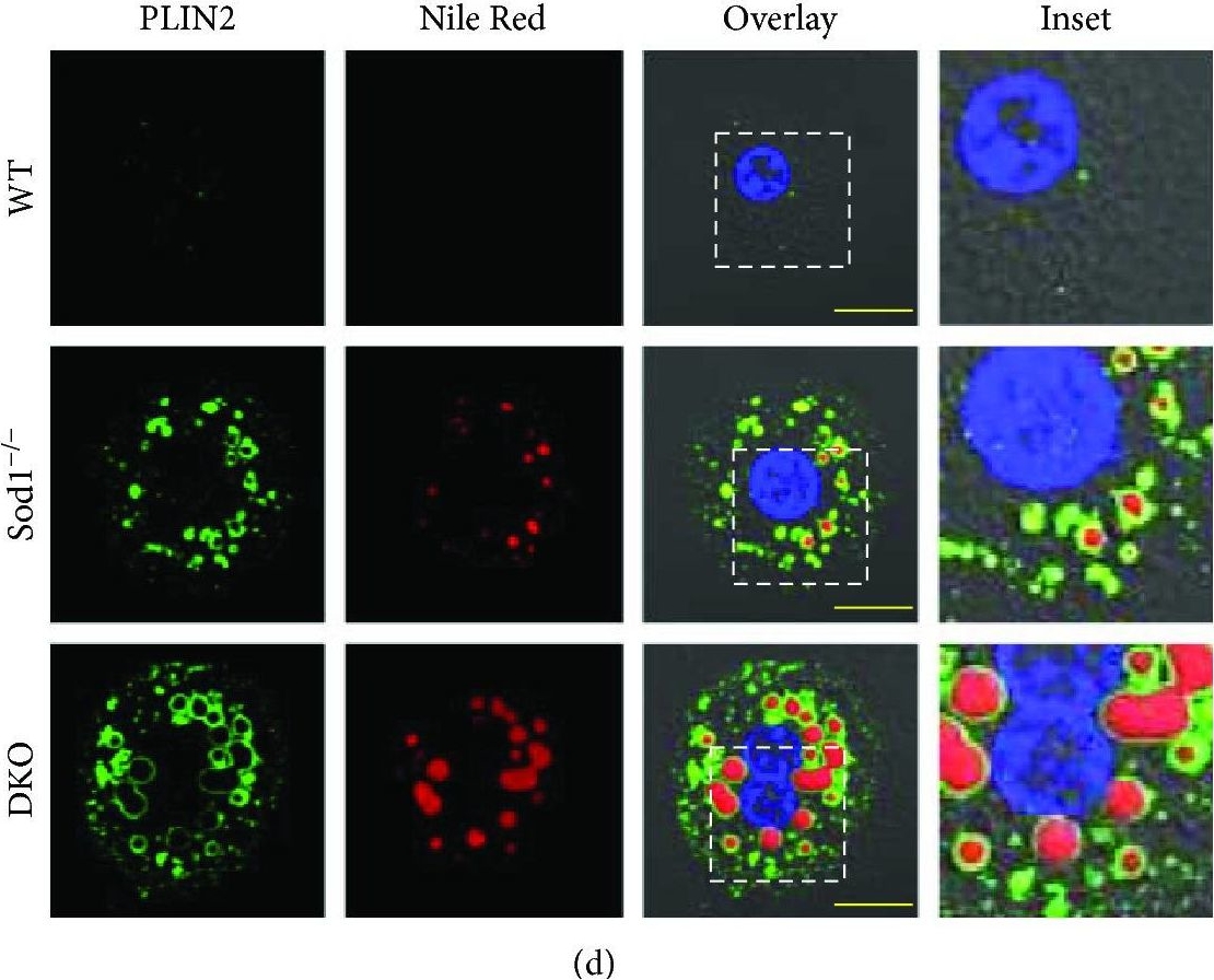 Double Knockout of Peroxiredoxin 4 (Prdx4) and Superoxide Dismutase 1 (Sod1) in Mice Results in Severe Liver Failure.