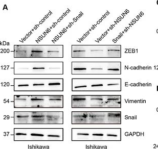 Fig.6.A showing Western Blotting from the publication: AL398, A Novel NSUN6 Inhibitor, Attenuates Epithelial-Mesenchymal Transition and Metastasis in Endometrial Cancer by Abrogating m5C-Dependent Stabilization of Snail mRNA.