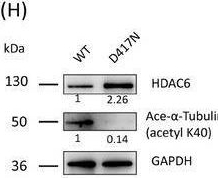 Fig.5.H showing Western Blotting in a Homo sapiens (Human) sample from the publication: Pathogenic variants of TUBB8 cause oocyte spindle defects by disrupting with EB1/CAKP5 interactions and potential treatment targeting microtubule acetylation through HDAC6 inhibition.