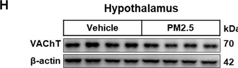 Fig.1.H showing Western Blotting in a Rattus norvegicus (Rat) sample from the publication: PM2.5 Exposure Triggers Hypothalamic Oxidative and ER Stress Leading to Depressive-like Behaviors in Rats.