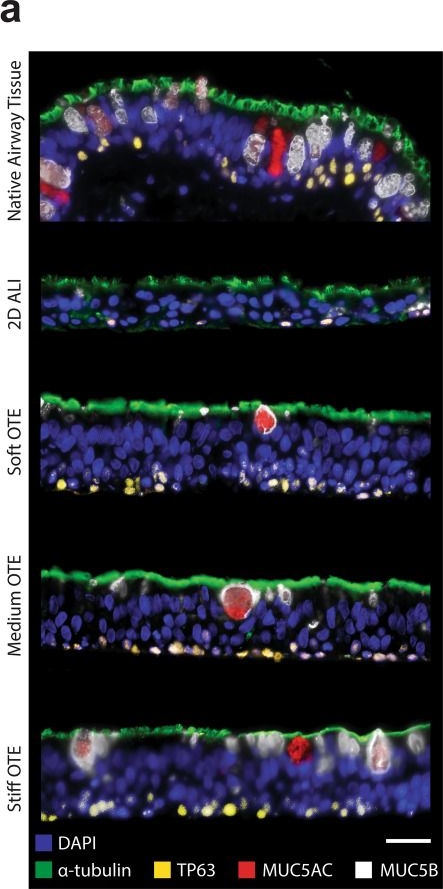 Fig.5.A showing Immunohistochemistry-immunofluorescence in a Homo sapiens (Human) sample from the publication: Development of a novel air-liquid interface airway tissue equivalent model for in vitro respiratory modeling studies.