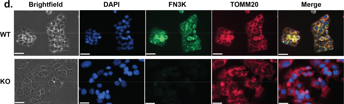 Fig.6.D showing Immunocytochemistry-immunofluorescence in a Homo sapiens (Human) sample from the publication: Multi-omics reveals new links between Fructosamine-3-Kinase (FN3K) and core metabolic pathways.