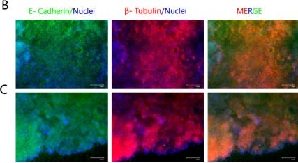 Fig.4.B showing Immunohistochemistry-immunofluorescence from the publication: Biodegradable Nanofiber Membranes for Air-Liquid Interface Culture: Advancing Airway In Vitro Models.