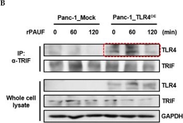 Fig.6.B showing Western Blotting in a Mus musculus (House mouse) sample from the publication: PAUF Induces Migration of Human Pancreatic Cancer Cells Exclusively via the TLR4/MyD88/NF-κB Signaling Pathway.