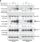 Fig.3.B showing Western Blotting from the publication: Biallelic JAK1 mutations in immunodeficient patient with mycobacterial infection.