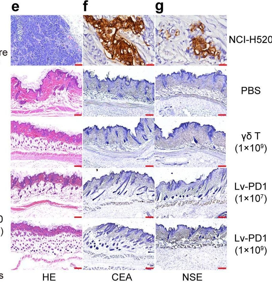 Fig.3.E showing Immunohistochemistry from the publication: Anti-PD-1 antibody armored γδ T cells enhance anti-tumor efficacy in ovarian cancer.