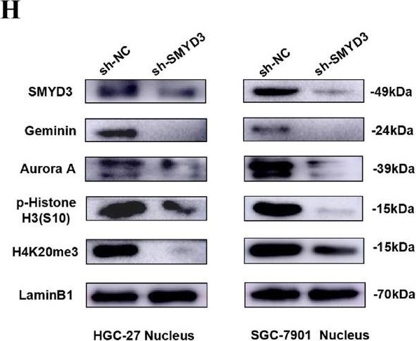 Fig.2.H showing Western Blotting in a Homo sapiens (Human) sample from the publication: SMYD3 drives the proliferation in gastric cancer cells via reducing EMP1 expression in an H4K20me3-dependent manner.