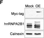 Fig.1.F showing Western Blotting in a Mus musculus (House mouse) sample from the publication: Small molecule inhibitors of hnRNPA2B1-RNA interactions reveal a predictable sorting of RNA subsets into extracellular vesicles.