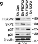 Fig.5.G showing Western Blotting from the publication: The β-TrCP-FBXW2-SKP2 axis regulates lung cancer cell growth with FBXW2 acting as a tumour suppressor.