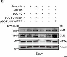 Fig.6.A showing Western Blotting in a Homo sapiens (Human) sample from the publication: Alternative spliceosomal protein Eftud2 mediated Kif3a exon skipping promotes SHH-subgroup medulloblastoma progression.