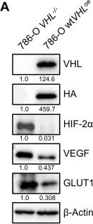 Fig.1.A showing Western Blotting from the publication: Microtubule dynamics is a therapeutic vulnerability in VHL-deficient renal cell carcinoma.