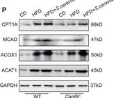 Fig.3.P showing Western Blotting from the publication: Gut Mycobiota-Associated Tryptophan Catabolites Protect Against Metabolic Dysfunction-Associated Steatotic Liver Disease.