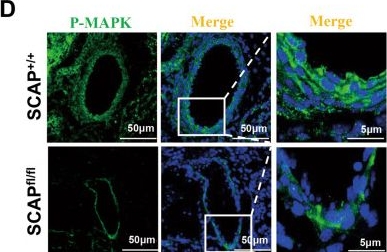 Fig.4.D showing Immunohistochemistry-immunofluorescence in a Mus musculus (House mouse) sample from the publication: SCAP contributes to embryonic angiogenesis by negatively regulating KISS-1 expression in mice.