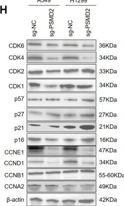 Fig.3.H showing Western Blotting in a Homo sapiens (Human) sample from the publication: Dual network analysis of transcriptome data for discovery of new therapeutic targets in non-small cell lung cancer.