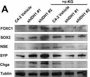 Fig.6.A showing Western Blotting from the publication: c-Fos-driven metabolic switch of α-ketoglutarate orchestrates progression in prostate cancer.
