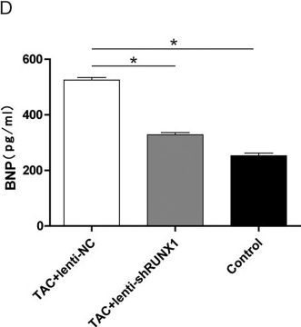 Fig.5.D showing Enzyme-linked immunosorbent assay from the publication: RUNX1 facilitates heart failure progression through regulating TGF-β-induced cardiac remodeling.