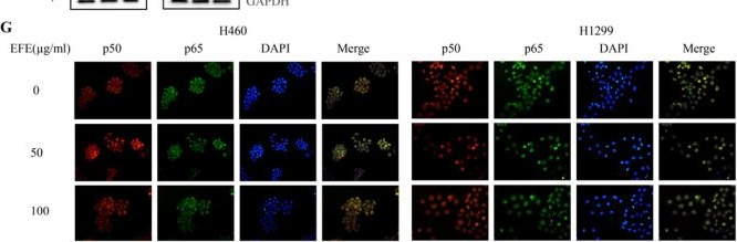 Fig.6.G showing Immunocytochemistry-immunofluorescence in a Homo sapiens (Human) sample from the publication: Lumbrokinase Extracted from Earthworms Synergizes with Bevacizumab and Chemotherapeutics in Treating Non-Small Cell Lung Cancer by Targeted Inactivation of BPTF/VEGF and NF-κB/COX-2 Signaling.
