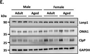 Fig.6.E showing Western Blotting from the publication: Unraveling sex differences in age-related hippocampal decline: differential mitochondrial dysfunction, Lonp1-dependent mitochondrial proteostasis and mtROS production in aged C57BL/6 mice.