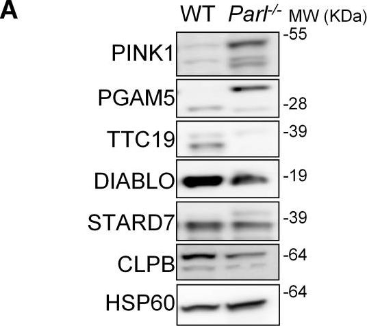Fig.3.A showing Western Blotting in a Mus musculus (House mouse) sample from the publication: Mitochondrial defects caused by PARL deficiency lead to arrested spermatogenesis and ferroptosis.