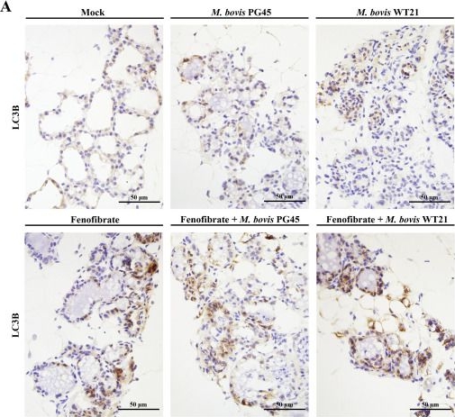 Fig.7.A showing Immunohistochemistry from the publication: Fenofibrate suppresses Mycoplasma bovis infection via autophagy-mediated cholesterol regulation in bovine mammary epithelial cells and murine mammary tissue.