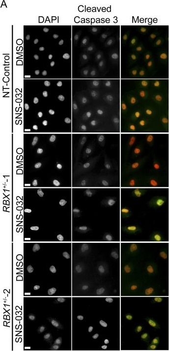 Fig.6.A showing Immunocytochemistry-immunofluorescence from the publication: RBX1 loss sensitizes tubo-ovarian, high-grade serous ovarian cells to CDK2 inhibition by SNS-032.