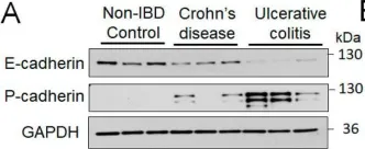 Fig.1.A showing Western Blotting from the publication: P-Cadherin Regulates Intestinal Epithelial Cell Migration and Mucosal Repair, but Is Dispensable for Colitis Associated Colon Cancer.
