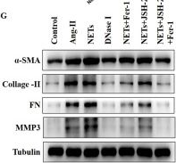 Fig.4.G showing Western Blotting from the publication: NETs drive myocardial fibrosis in hypertension via an NF-κB/ferroptosis axis.