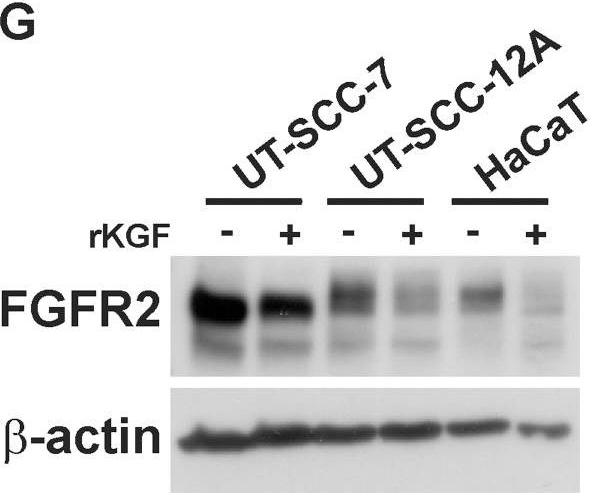 Fig.6.G showing Western Blotting in a Homo sapiens (Human) sample from the publication: Keratinocyte growth factor induces gene expression signature associated with suppression of malignant phenotype of cutaneous squamous carcinoma cells.