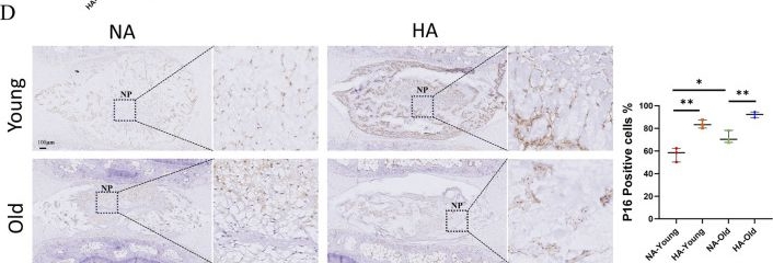 Fig.5.D showing Immunohistochemistry in a Rattus norvegicus (Rat) sample from the publication: Effects of high-altitude environments on intervertebral disc degeneration and transcriptome profiling of the nucleus pulposus.