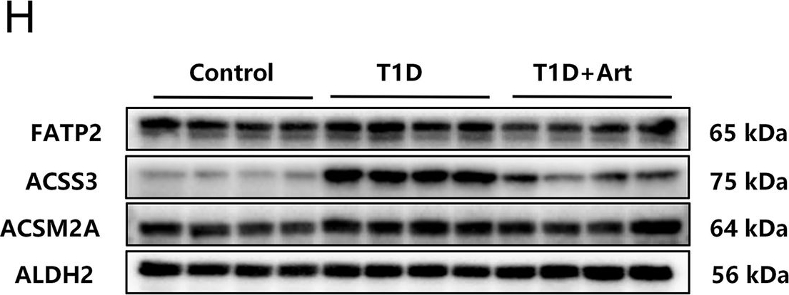 Fig.5.H showing Western Blotting in a Mus musculus (House mouse) sample from the publication: Artemether ameliorates type 1 diabetic liver injury alongside the associated defects in mitochondrial ultrastructure and central carbon metabolism.
