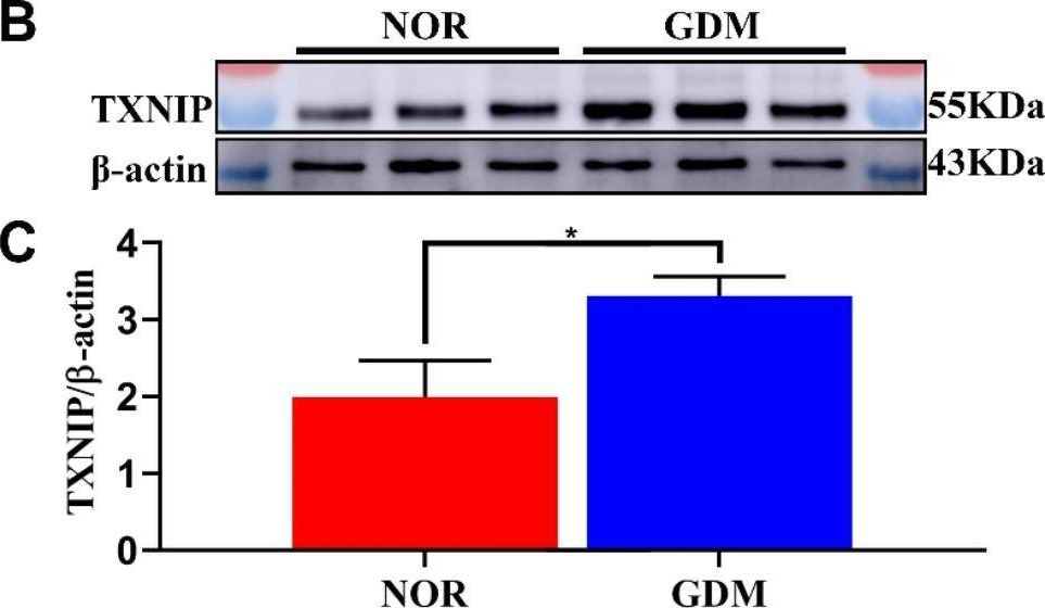 Fig.1.B showing Western Blotting from the publication: High TXNIP expression accelerates the migration and invasion of the GDM placenta trophoblast.