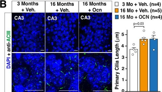 Fig.6.B showing Immunohistochemistry-immunofluorescence in a Mus musculus (House mouse) sample from the publication: A primary cilia-autophagy axis in hippocampal neurons is essential to maintain cognitive resilience.