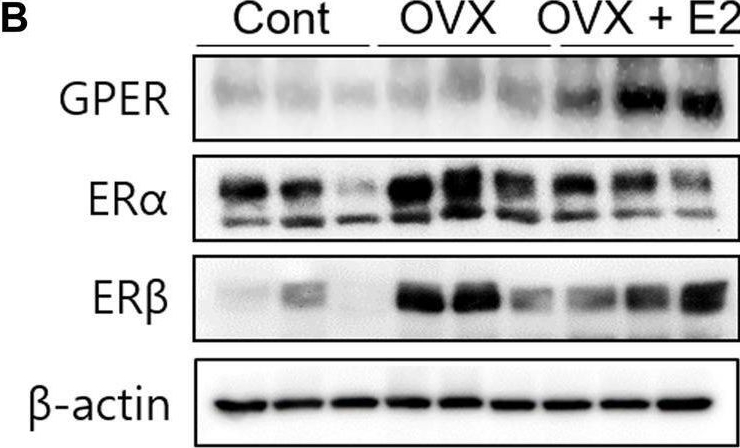Fig.4.B showing Western Blotting from the publication: Estrogen Aggravates Tumor Growth in a Diffuse Gastric Cancer Xenograft Model.
