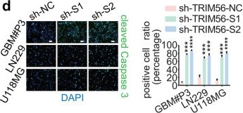 Fig.2.D showing Immunocytochemistry-immunofluorescence from the publication: TRIM56 promotes malignant progression of glioblastoma by stabilizing cIAP1 protein.