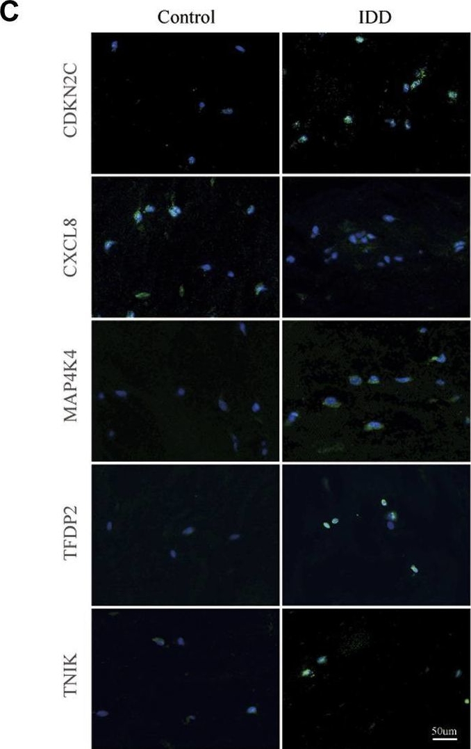 Fig.6.C showing Immunocytochemistry-immunofluorescence from the publication: Comprehensive analysis of senescence-related genes and immune infiltration in intervertebral disc degeneration: a meta-data approach utilizing bulk and single-cell RNA sequencing data.
