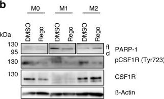 Fig.4.B showing Western Blotting from the publication: Anti-angiogenic therapy using the multi-tyrosine kinase inhibitor Regorafenib enhances tumor progression in a transgenic mouse model of ß-cell carcinogenesis.